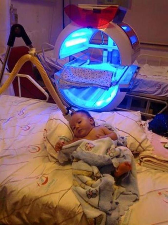 Bebeklere evde fototerapi uygulanmaya başlandı.